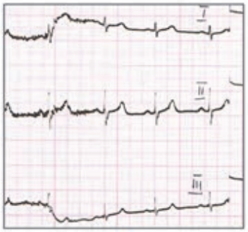 Ilustracja do odpowiedzi B