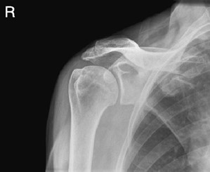 Ilustracja do pytania 8