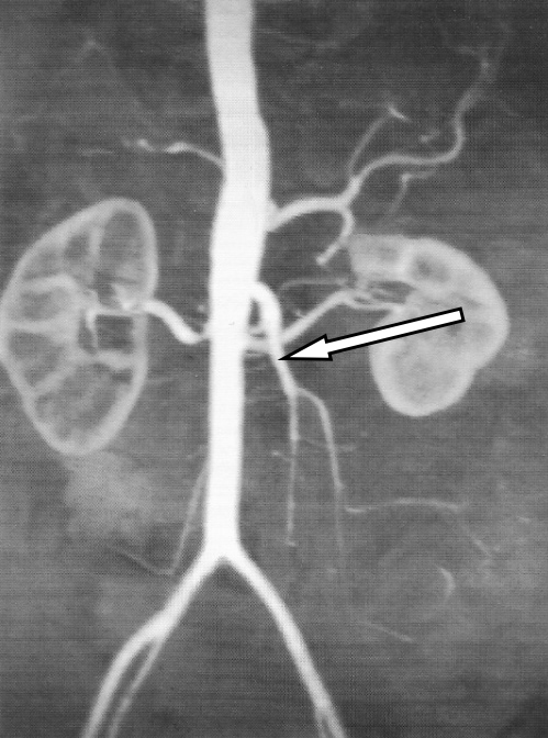 Ilustracja do pytania 29