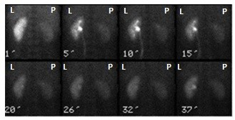 Ilustracja do pytania 17