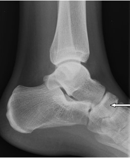 Ilustracja do pytania 28