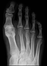 Ilustracja do pytania 34