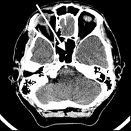 Ilustracja do pytania 14