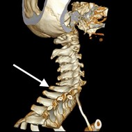 Ilustracja do pytania 8