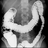 Ilustracja do pytania 23