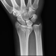 Ilustracja do pytania 9