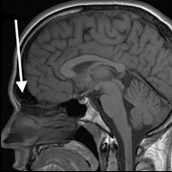 Ilustracja do pytania 26