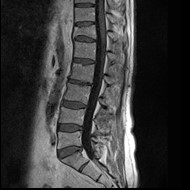 Ilustracja do pytania 26