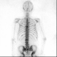 Ilustracja do pytania 38