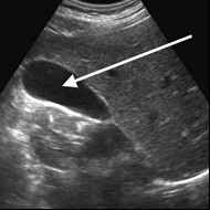 Ilustracja do pytania 22