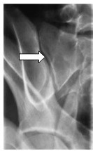 Ilustracja do pytania 24