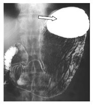 Ilustracja do pytania 18