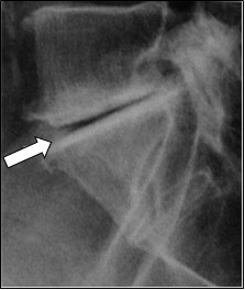 Ilustracja do pytania 35