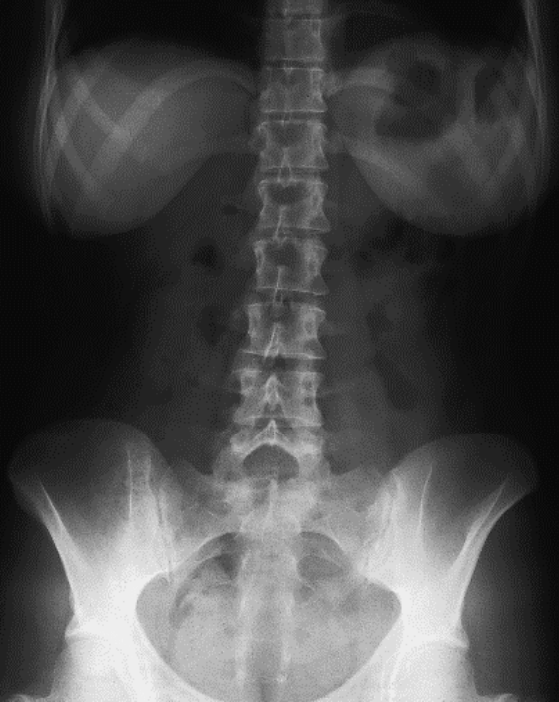 Ilustracja do odpowiedzi C