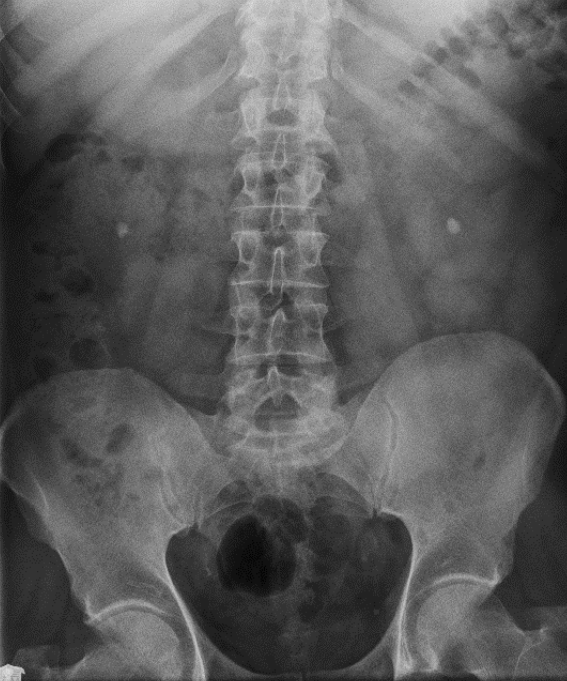 Ilustracja do odpowiedzi D