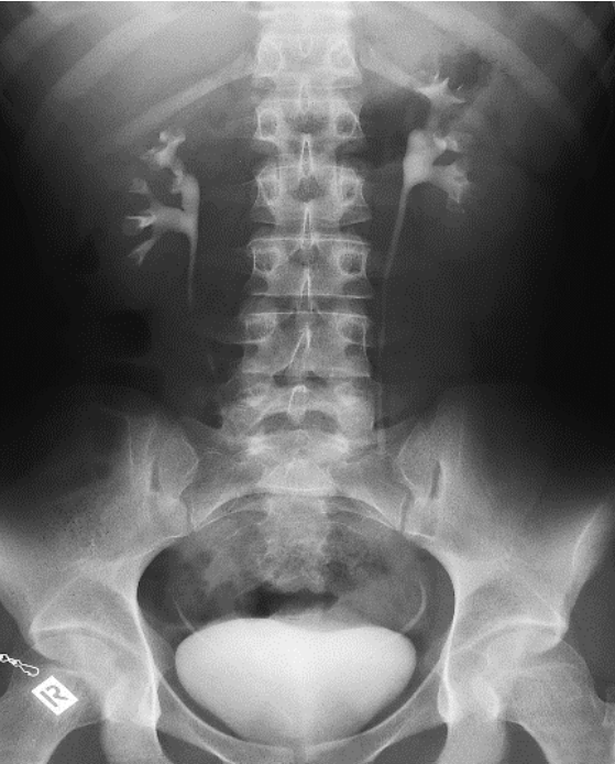 Ilustracja do odpowiedzi B