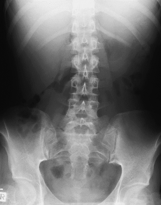 Ilustracja do odpowiedzi A