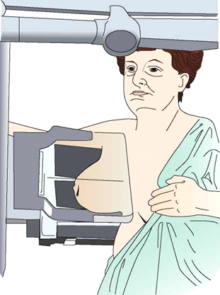 Ilustracja do pytania 20