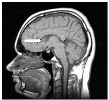 Ilustracja do pytania 1