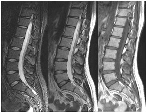 Ilustracja do pytania 37