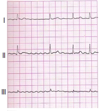 Ilustracja do pytania 5