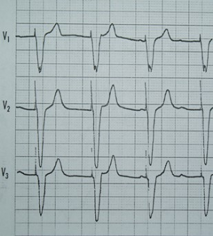Ilustracja do odpowiedzi D