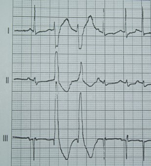 Ilustracja do odpowiedzi B