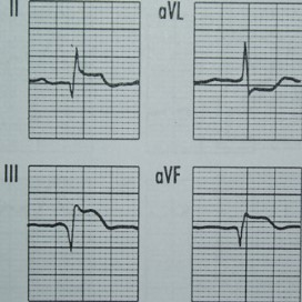 Ilustracja do odpowiedzi C
