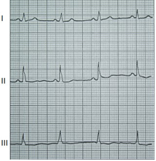 Ilustracja do odpowiedzi A