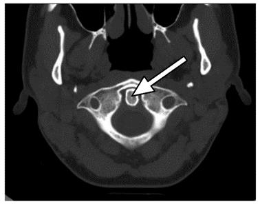 Ilustracja do pytania 32