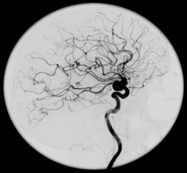 Ilustracja do pytania 34