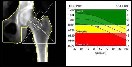 Ilustracja do pytania 14