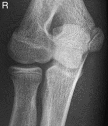 Ilustracja do odpowiedzi A