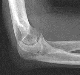 Ilustracja do odpowiedzi D