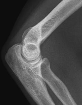 Ilustracja do odpowiedzi B