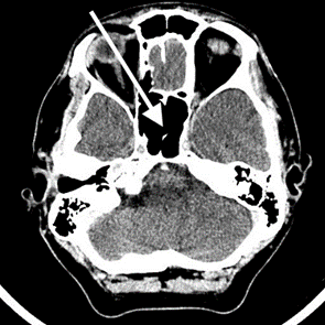 Ilustracja do pytania 2