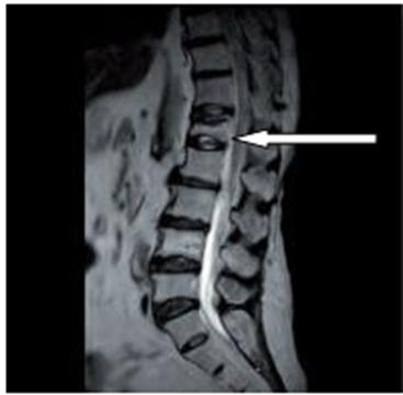 Ilustracja do pytania 17