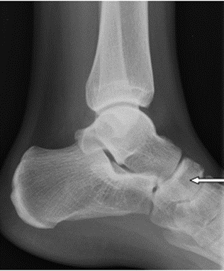 Ilustracja do pytania 36