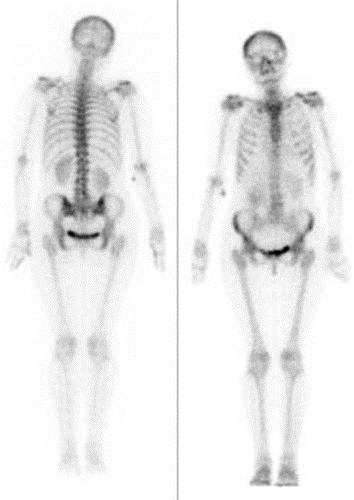 Ilustracja do pytania 30