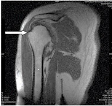 Ilustracja do pytania 23