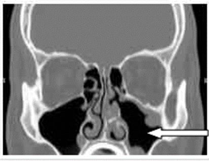 Ilustracja do pytania 21