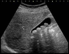 Ilustracja do pytania 14