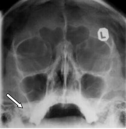 Ilustracja do pytania 35