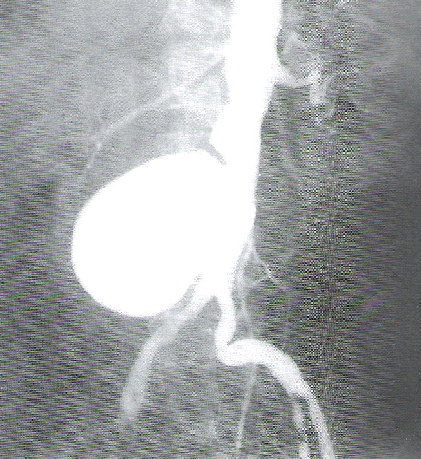 Ilustracja do pytania 33