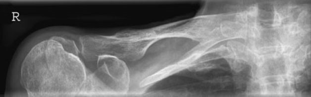 Ilustracja do pytania 38