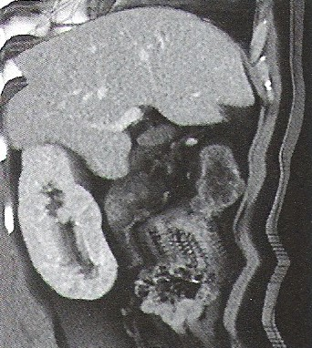 Ilustracja do odpowiedzi B