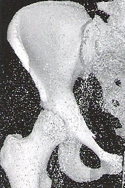 Ilustracja do odpowiedzi D