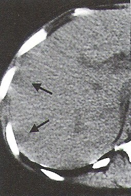 Ilustracja do odpowiedzi A