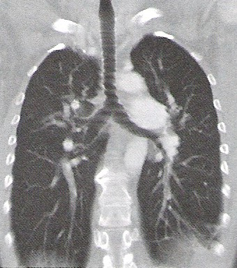 Ilustracja do odpowiedzi C