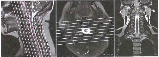 Ilustracja do pytania 19